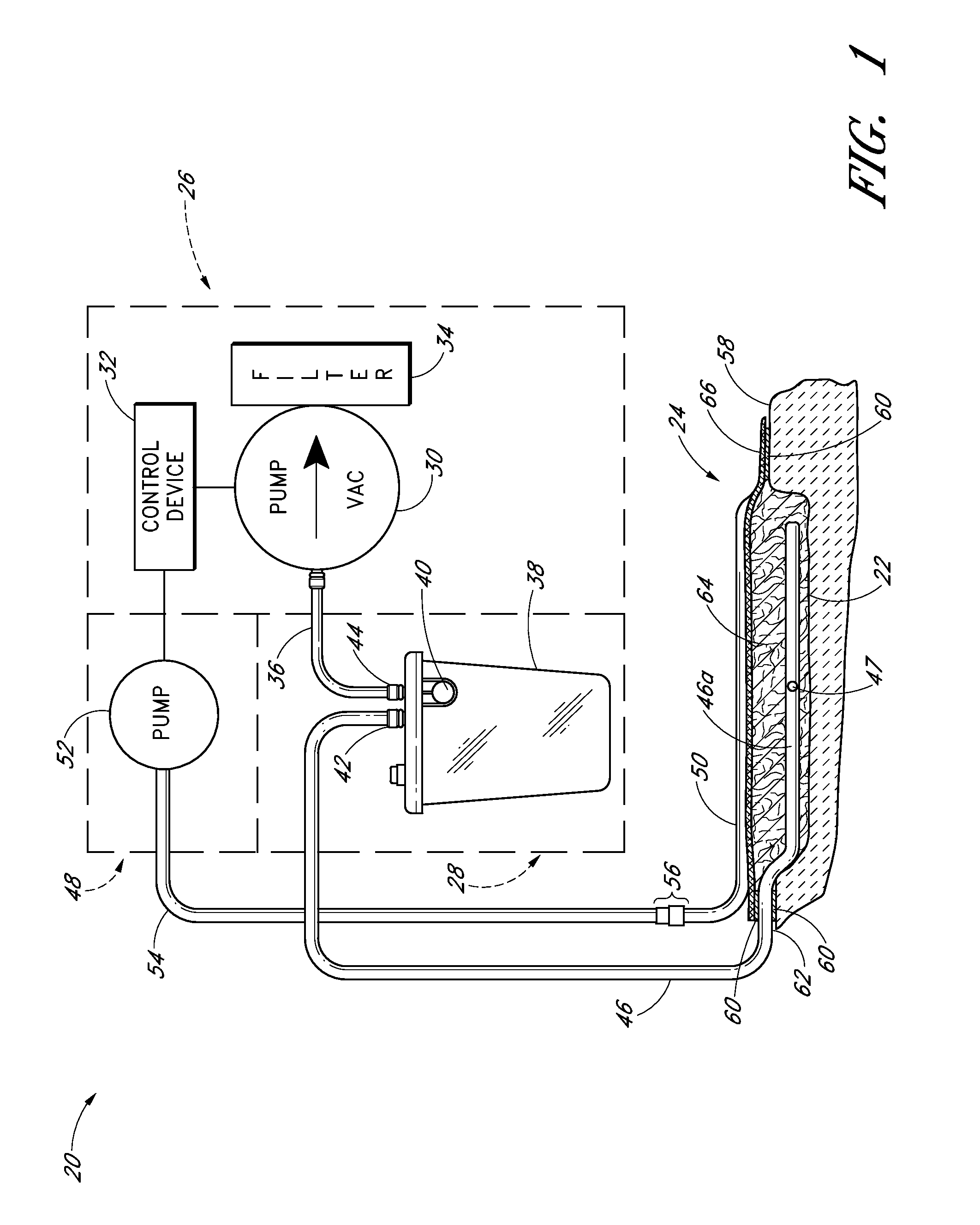 Negative Pressure Dressing and Method of Using Same