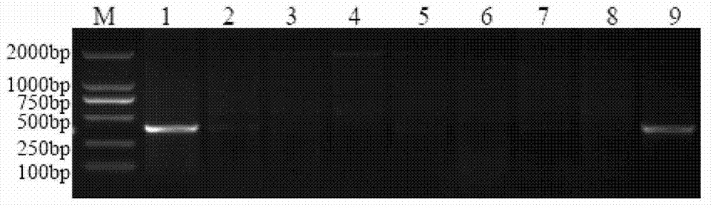 SLAF-seq-based developed elytrigia elongata 1E chromosome specific molecular markers and application thereof