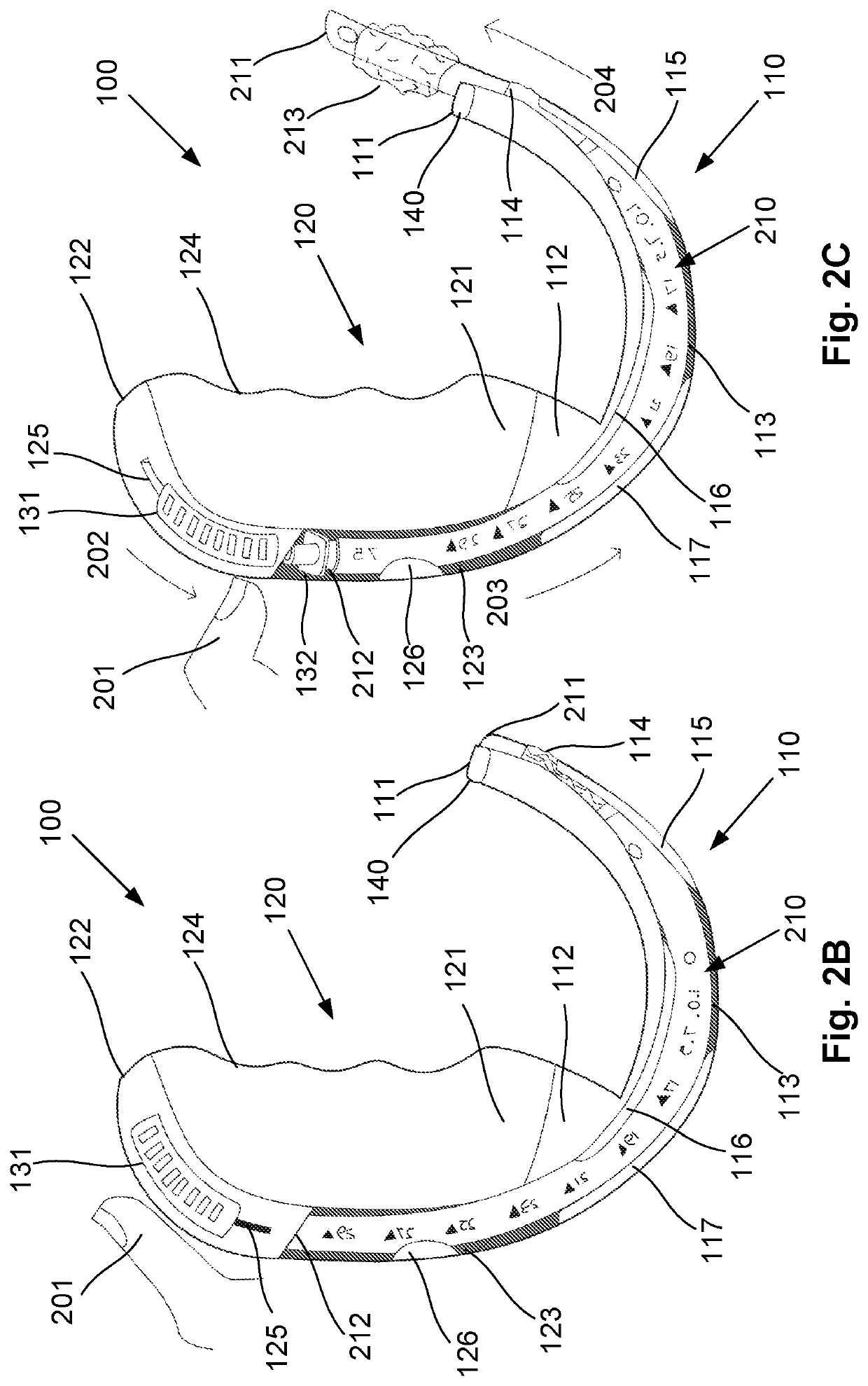 Intubation device improvements