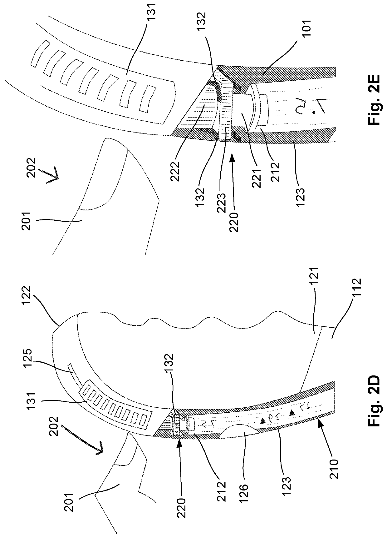 Intubation device improvements