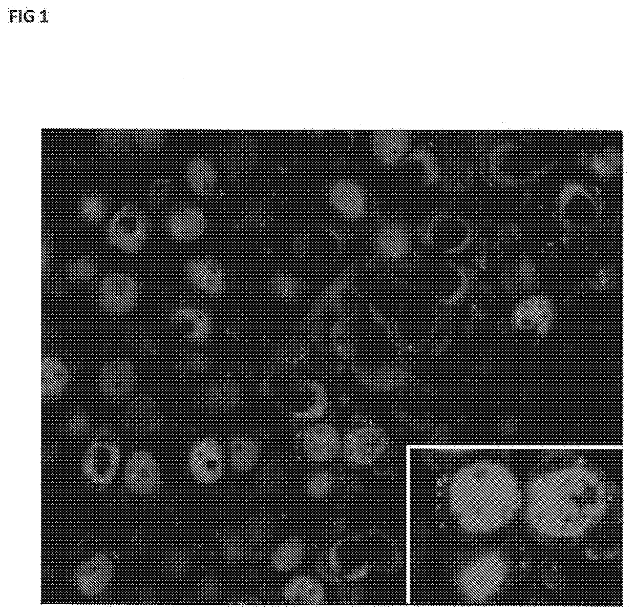 Exosomes and uses thereof in diseases of the brain