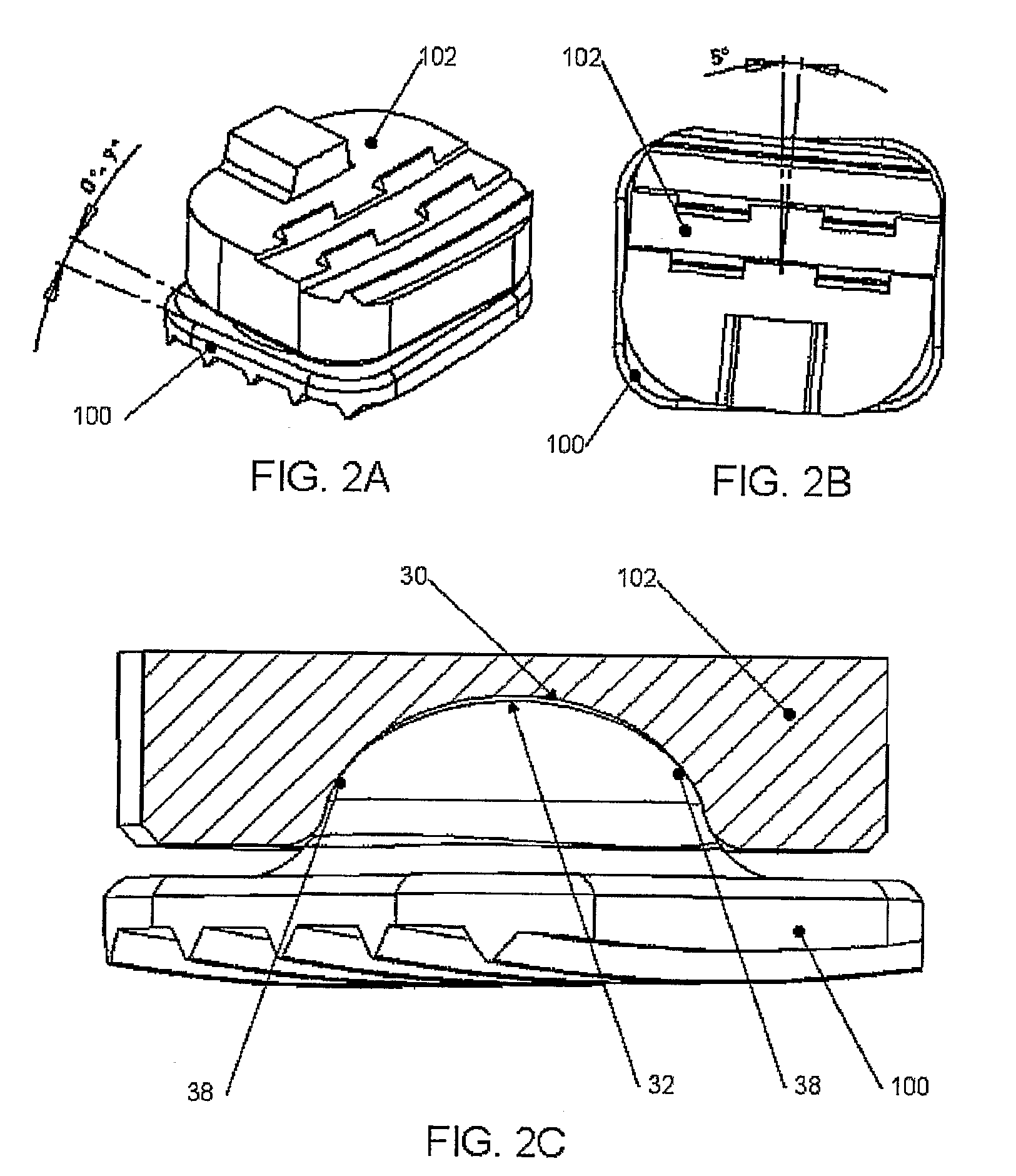 Intervertebral disc replacement