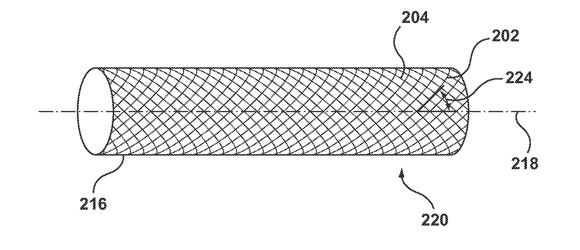 Method of Making an Endoluminal Vascular Prosthesis