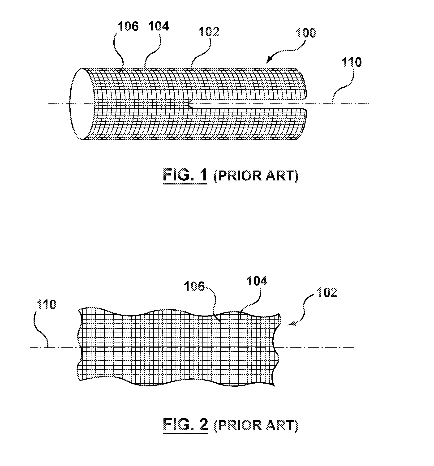 Method of Making an Endoluminal Vascular Prosthesis