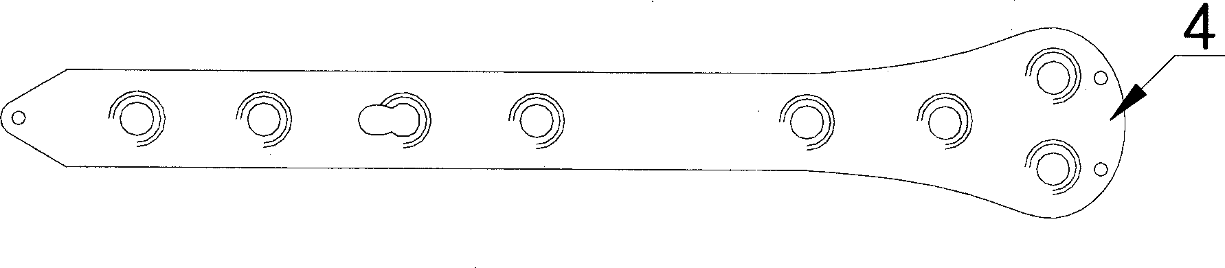 Non-contact arcuated stress bone plate for epiphysis