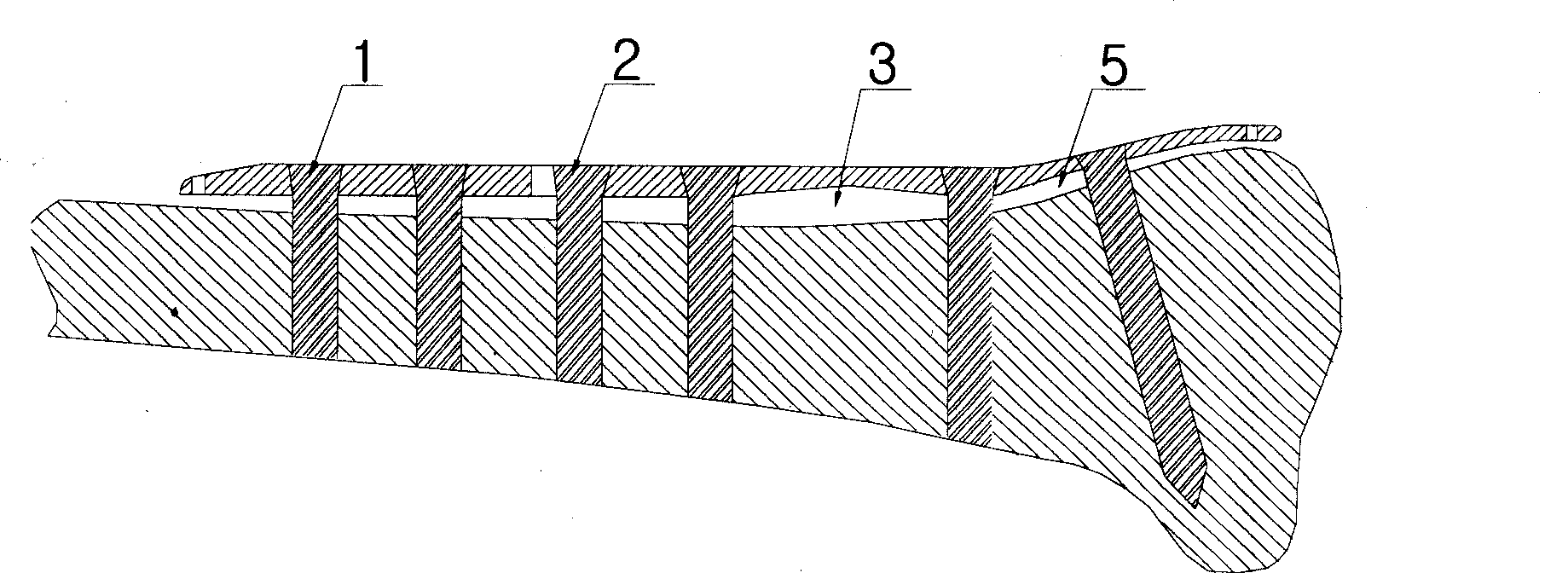 Non-contact arcuated stress bone plate for epiphysis