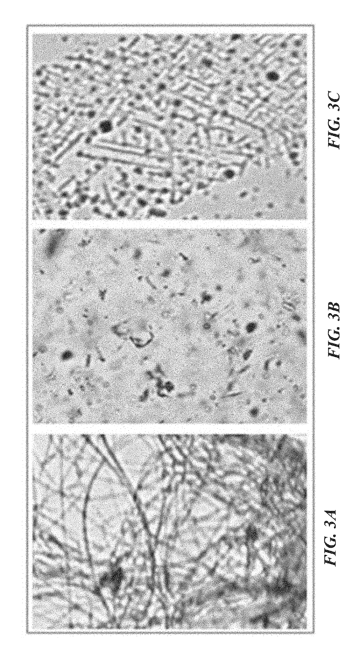 Collagenase assay