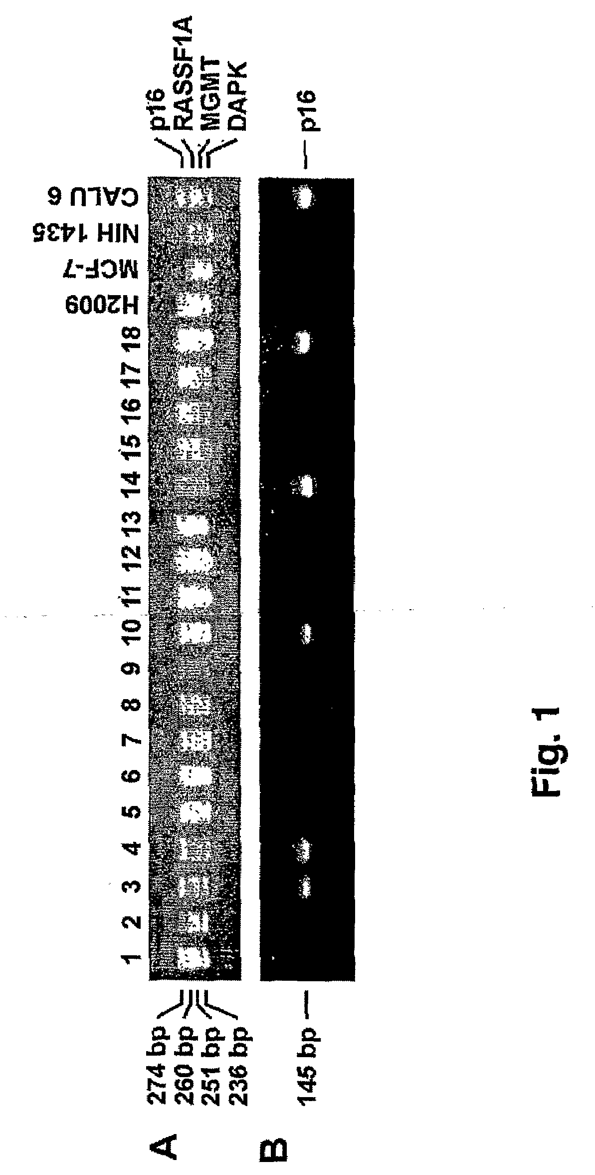 Gene Methylation as a Biomarker in Sputum