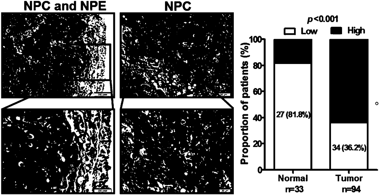 Application of interfering long-chain non-coding RNA PVT1 expression agent in the preparation of nasopharyngeal carcinoma radiotherapy sensitizer