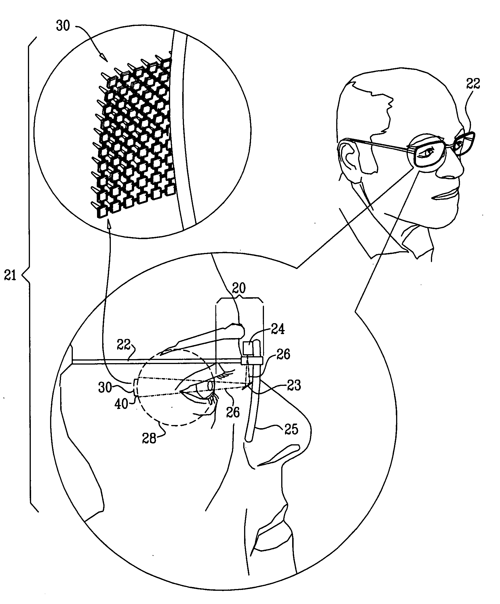 Retinal prosthesis