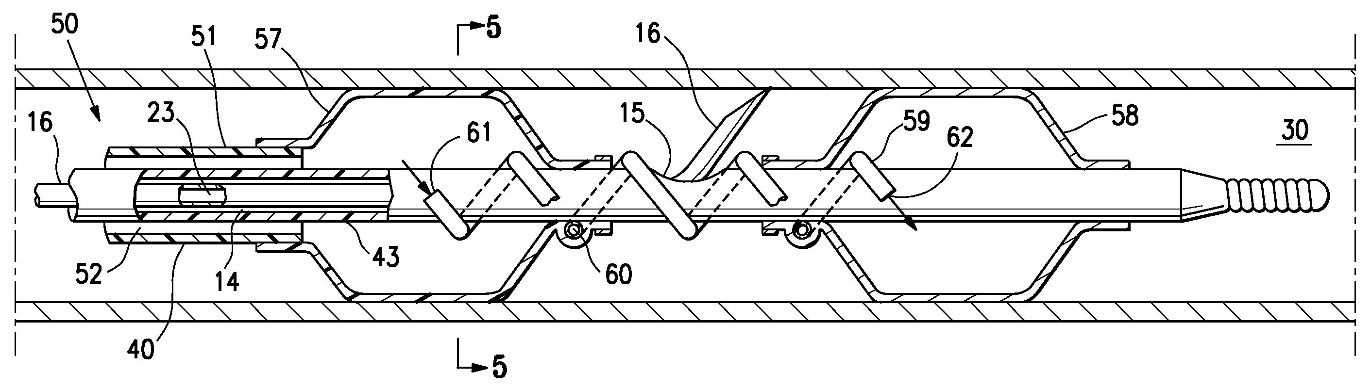 Agent delivery catheter having an inflation bridge between two axially spaced balloons