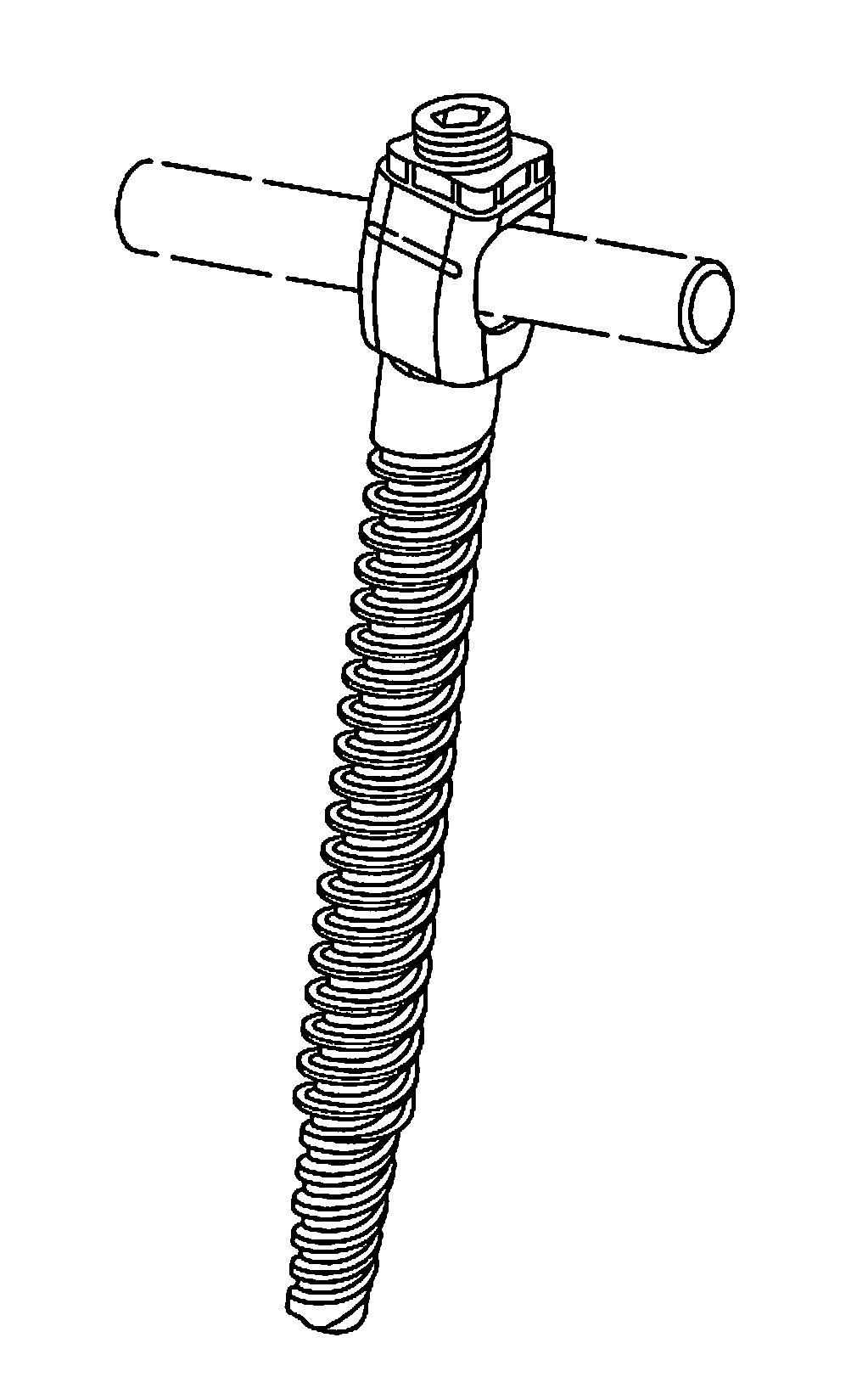 Closed-Head Polyaxial and Monaxial Screws