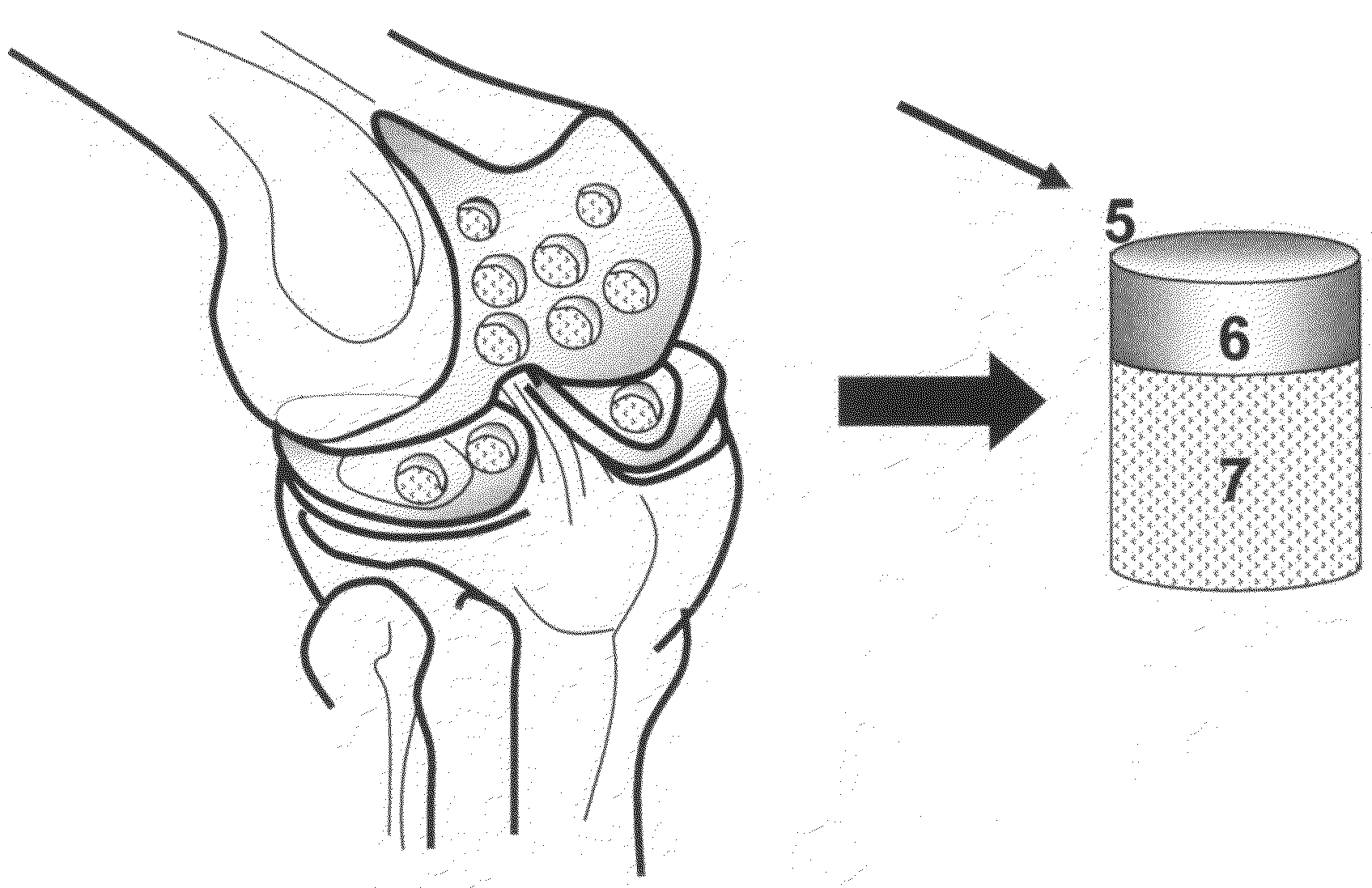 Devitalization and recellularization of cartilage