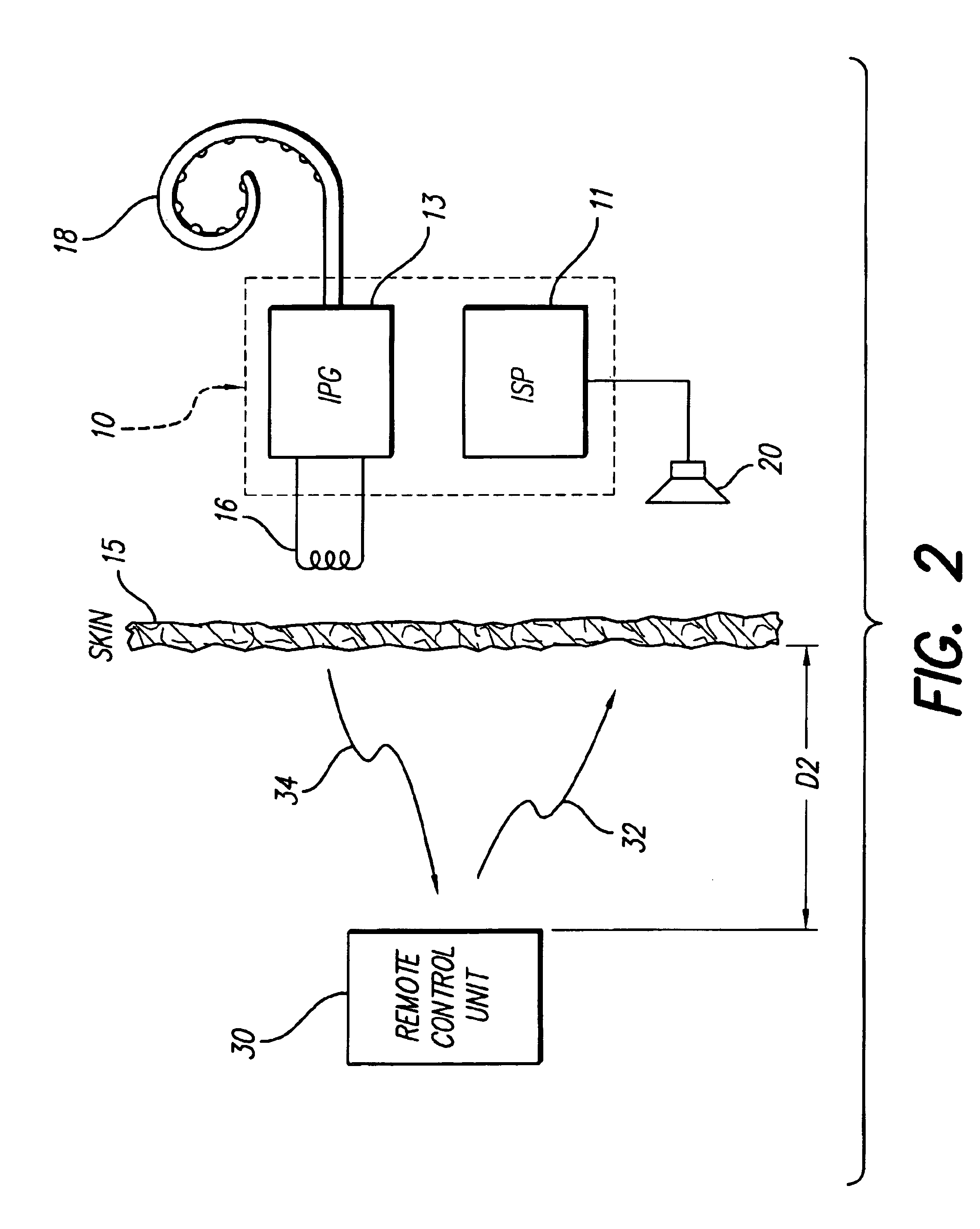 Implantable neural stimulator system including remote control unit for use therewith