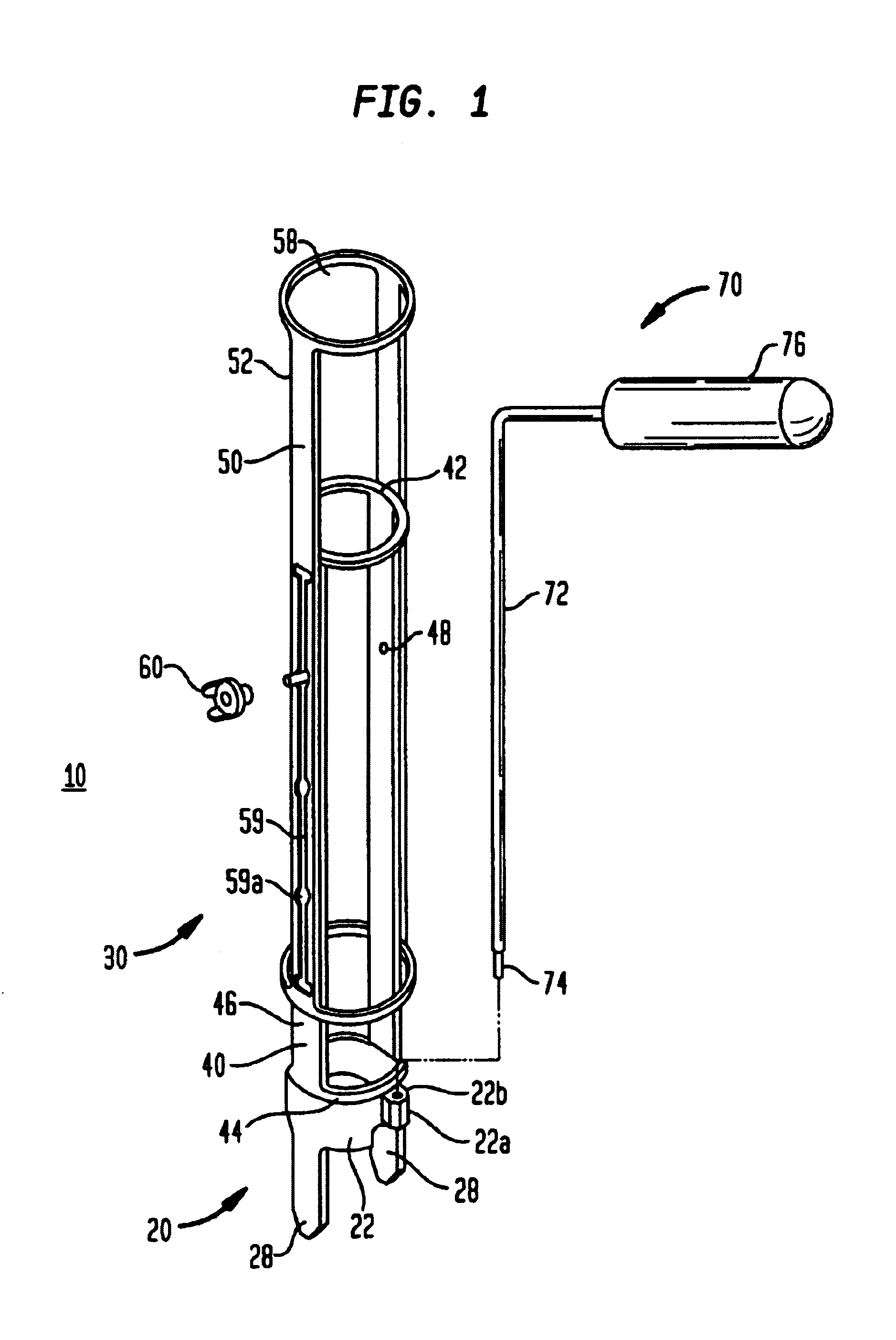 Instrumentation and method for implant insertion