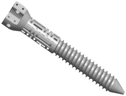 Pedicle screw with pullout resistance