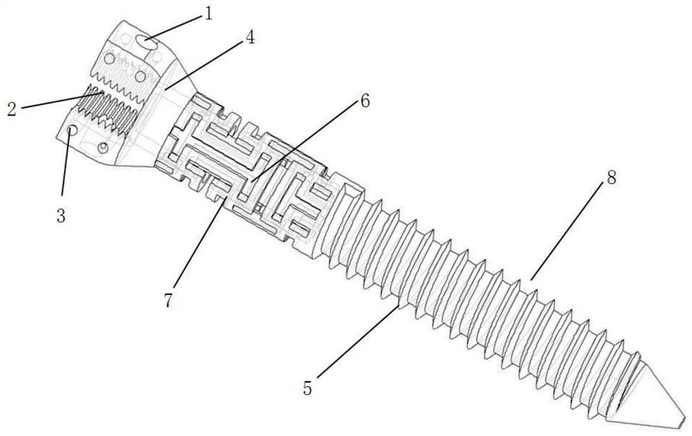 Pedicle screw with pullout resistance