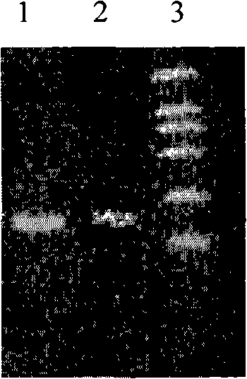 Method for producing human amyloid A&lt;beta&gt;1-42 with methylotrophy yeast