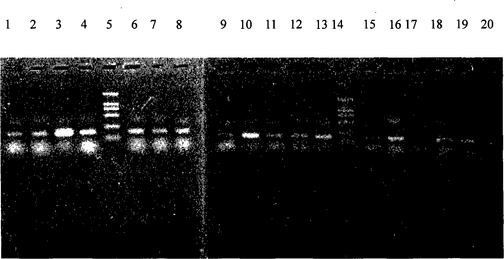 Method for producing human amyloid A&lt;beta&gt;1-42 with methylotrophy yeast