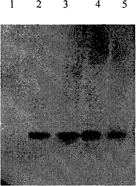 Method for producing human amyloid A&lt;beta&gt;1-42 with methylotrophy yeast