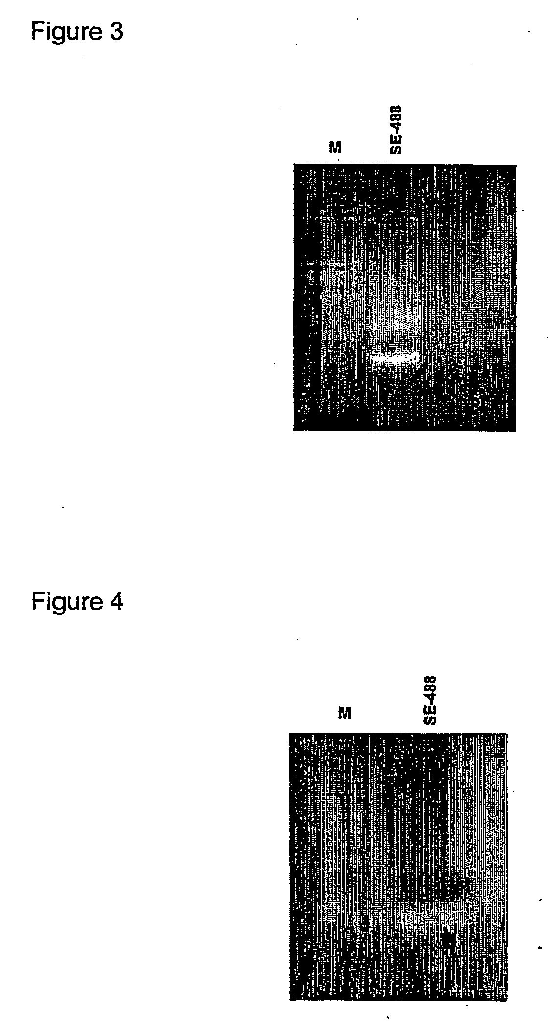 Restoration of methylation states in cells