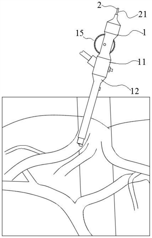 Novel pressure-measuring thrombectomy puncture ablation adjustable catheter