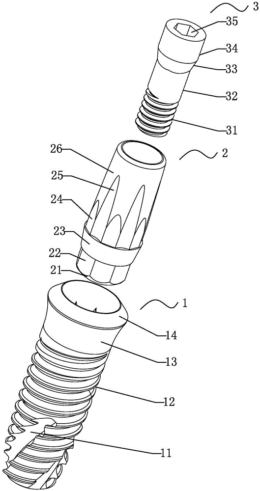 Easy-to-remove implant set and its screw-out tool