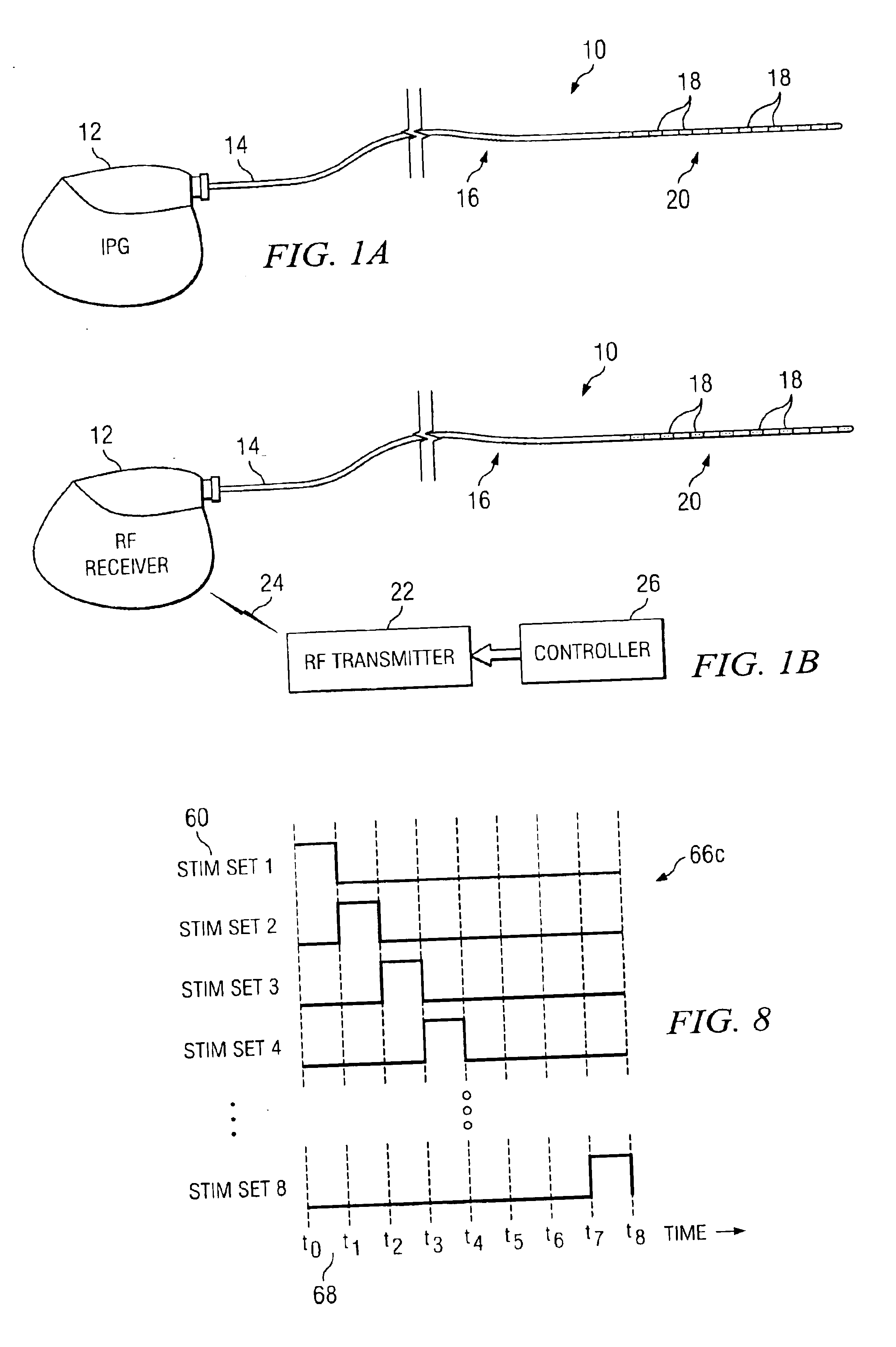 System and method for stimulation of a person's brain stem