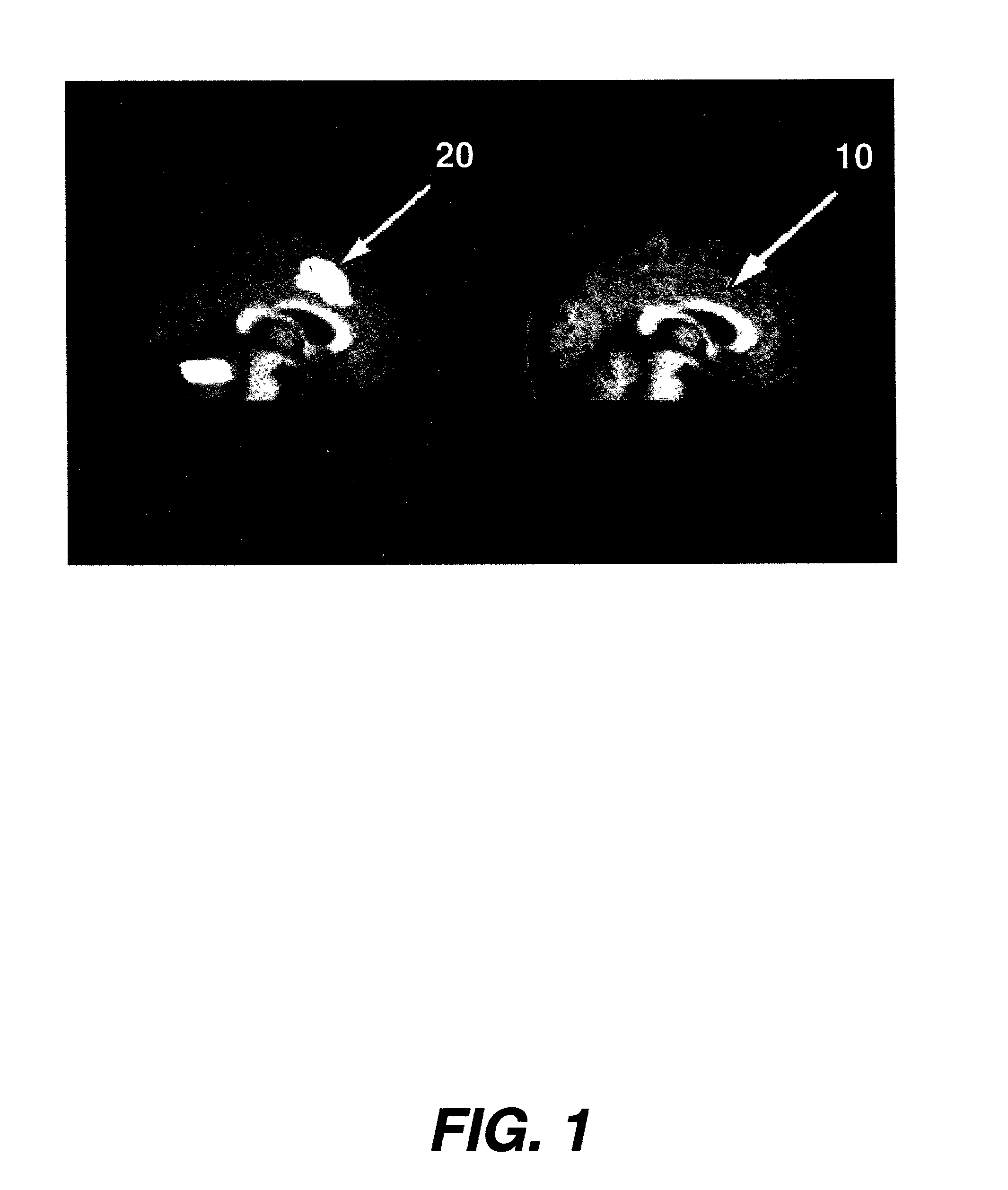 Polygraph utilizing medical imaging