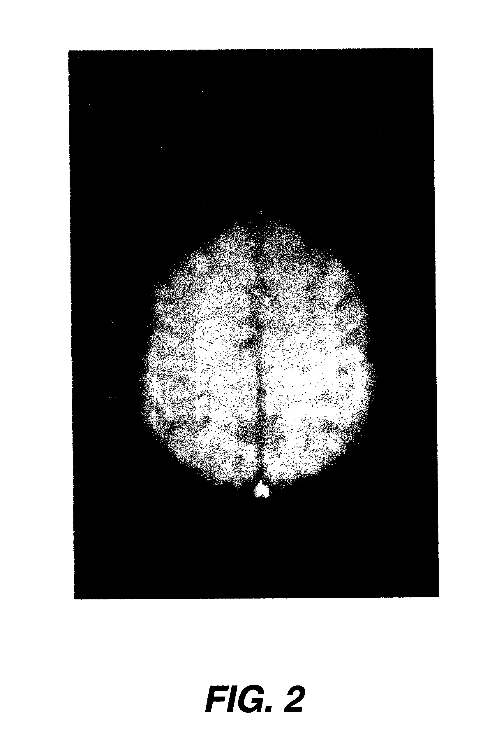 Polygraph utilizing medical imaging