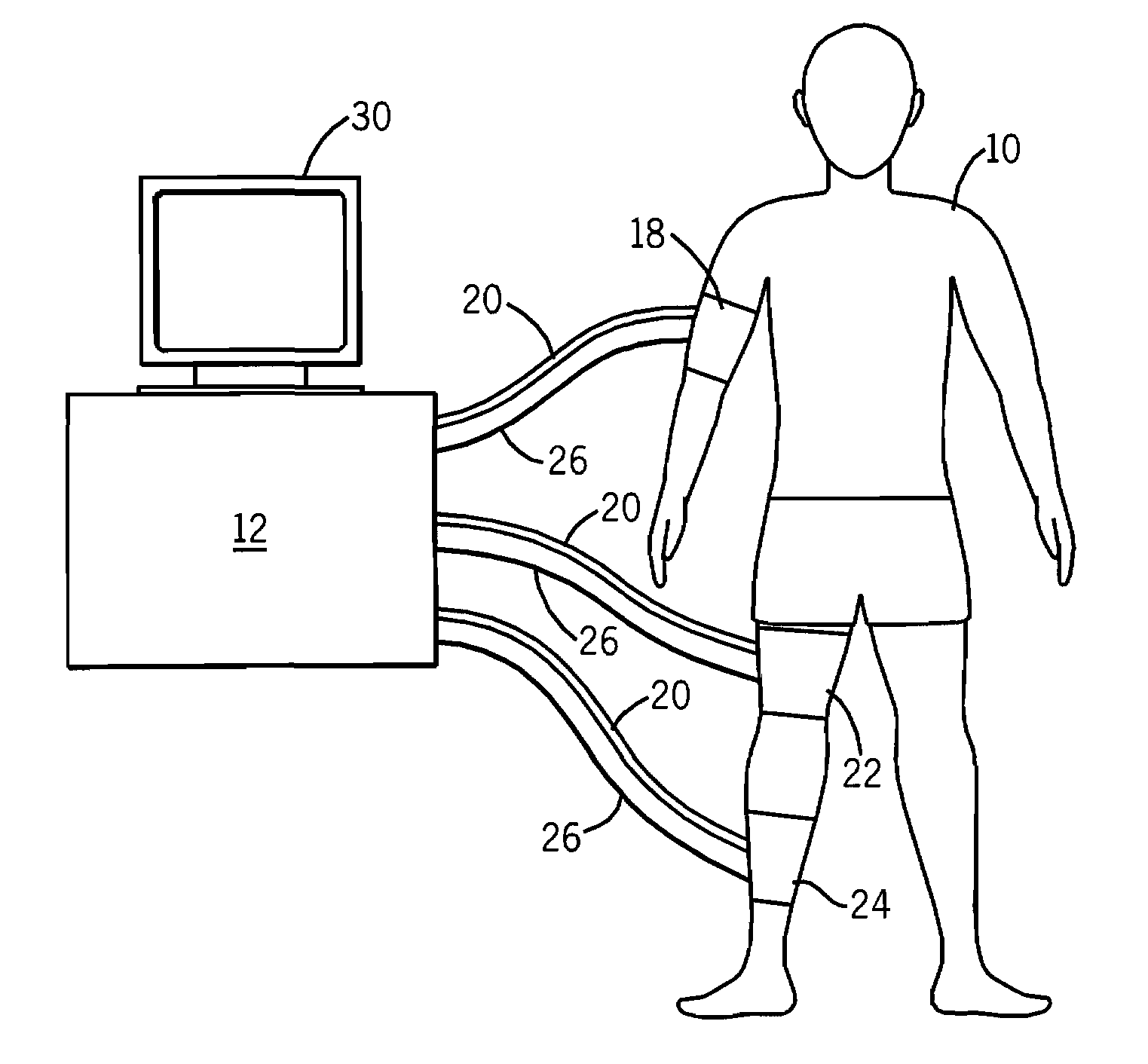 Intermittent pneumatic compression device with non-invasive blood pressure monitoring