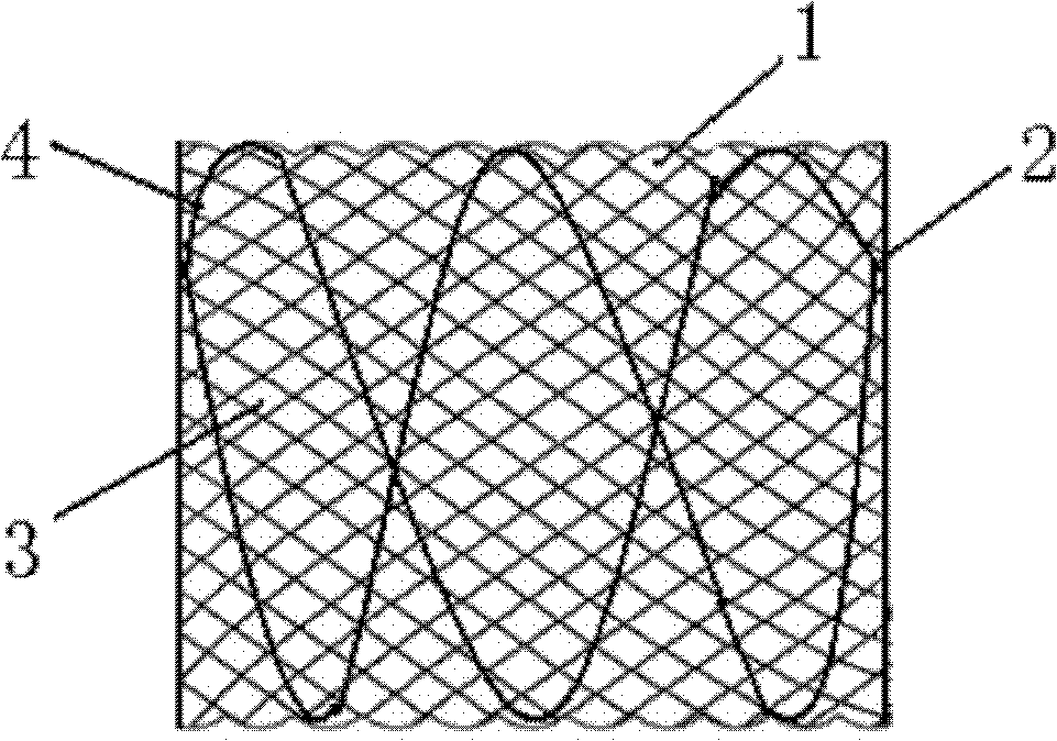 Valve aortal stent planted above opening of percutaneous coronary