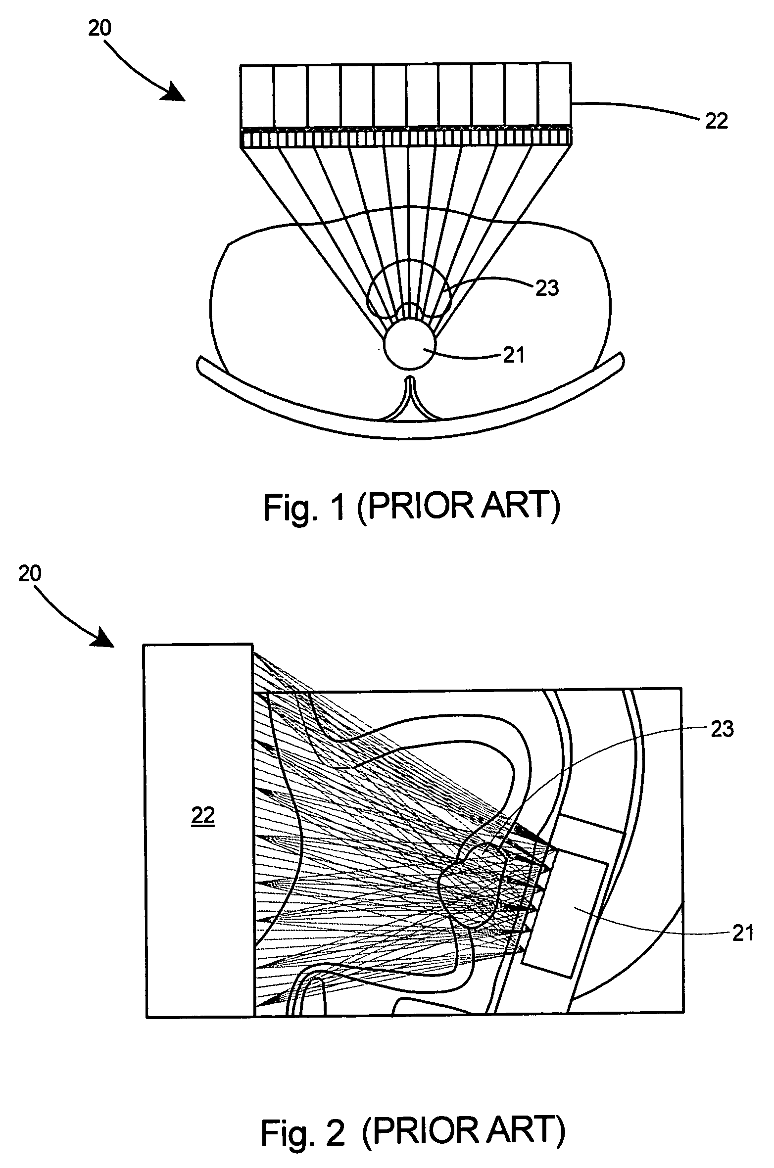 Dedicated mobile high resolution prostate PET imager with an insertable transrectal probe