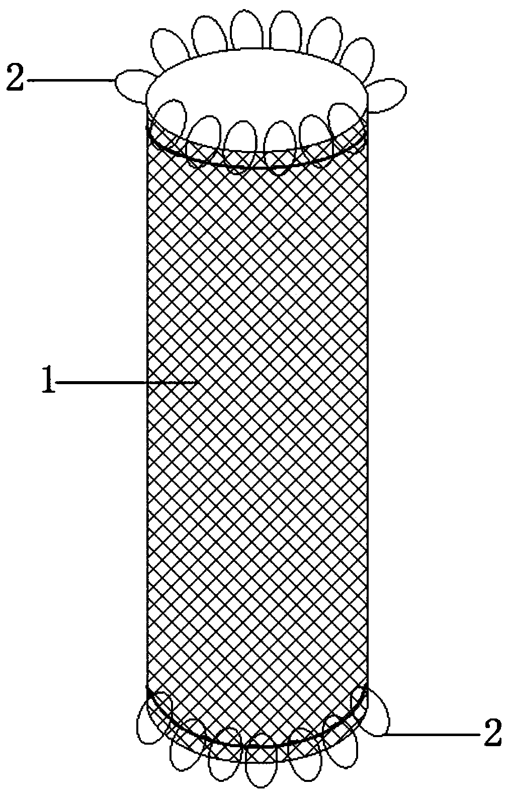 Novel fixed, recyclable and anti-displacement esophagus metal stent