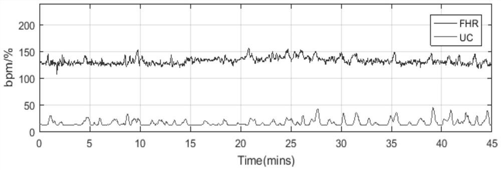 A Coupling Analysis Method of Fetal Heart Rate and Uterine Contraction Signal