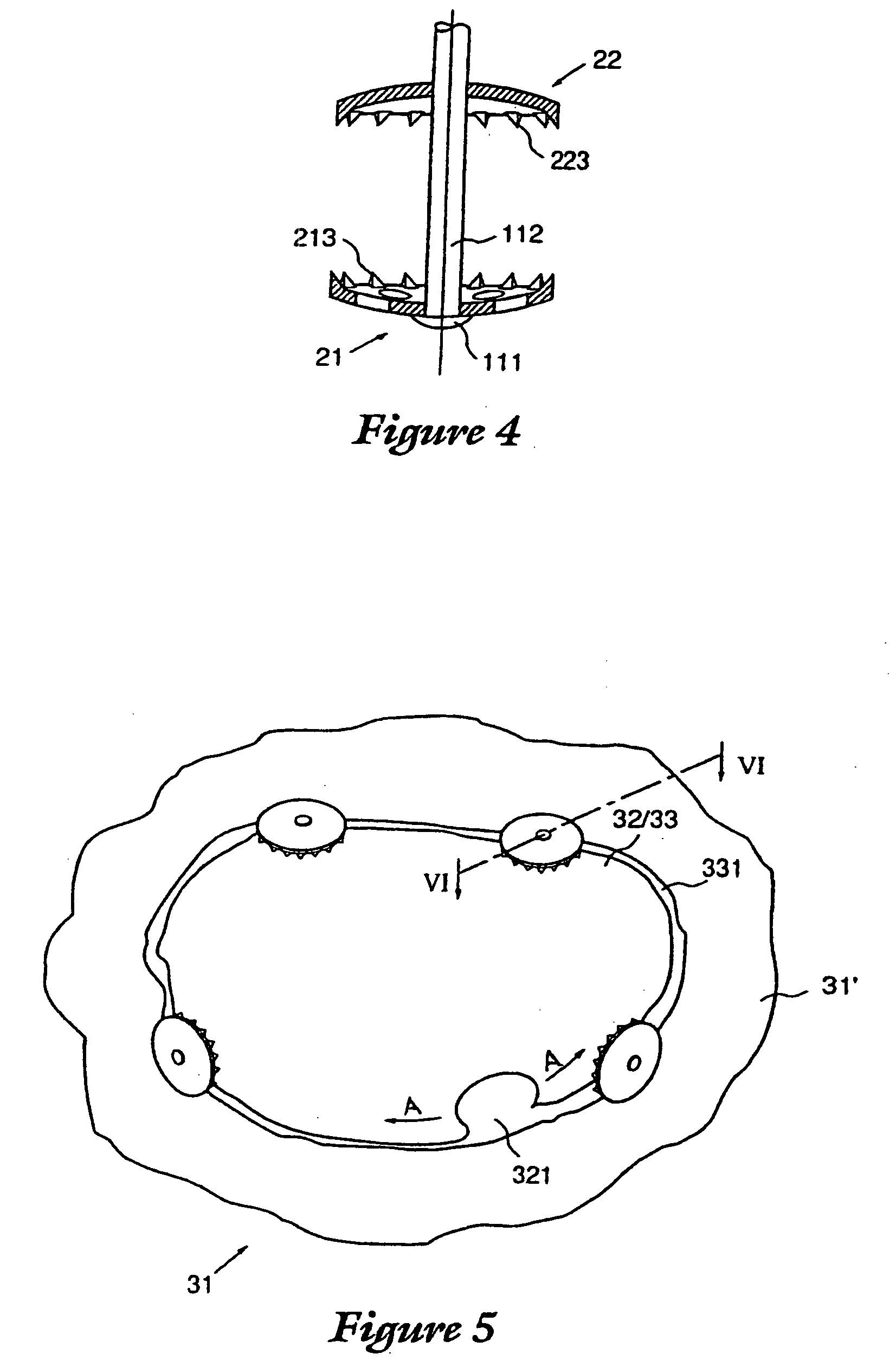 Device for postoperative fixation back into the cranium of a plug of bone removed therefrom during a surgical operation