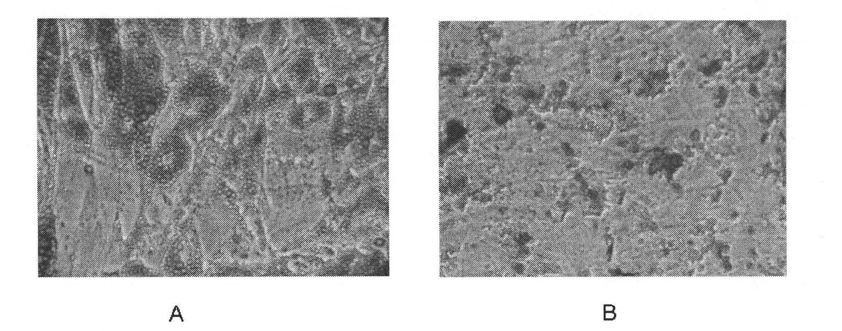 Method for extracting original mesenchymal stem cells from placenta and serum-free amplification