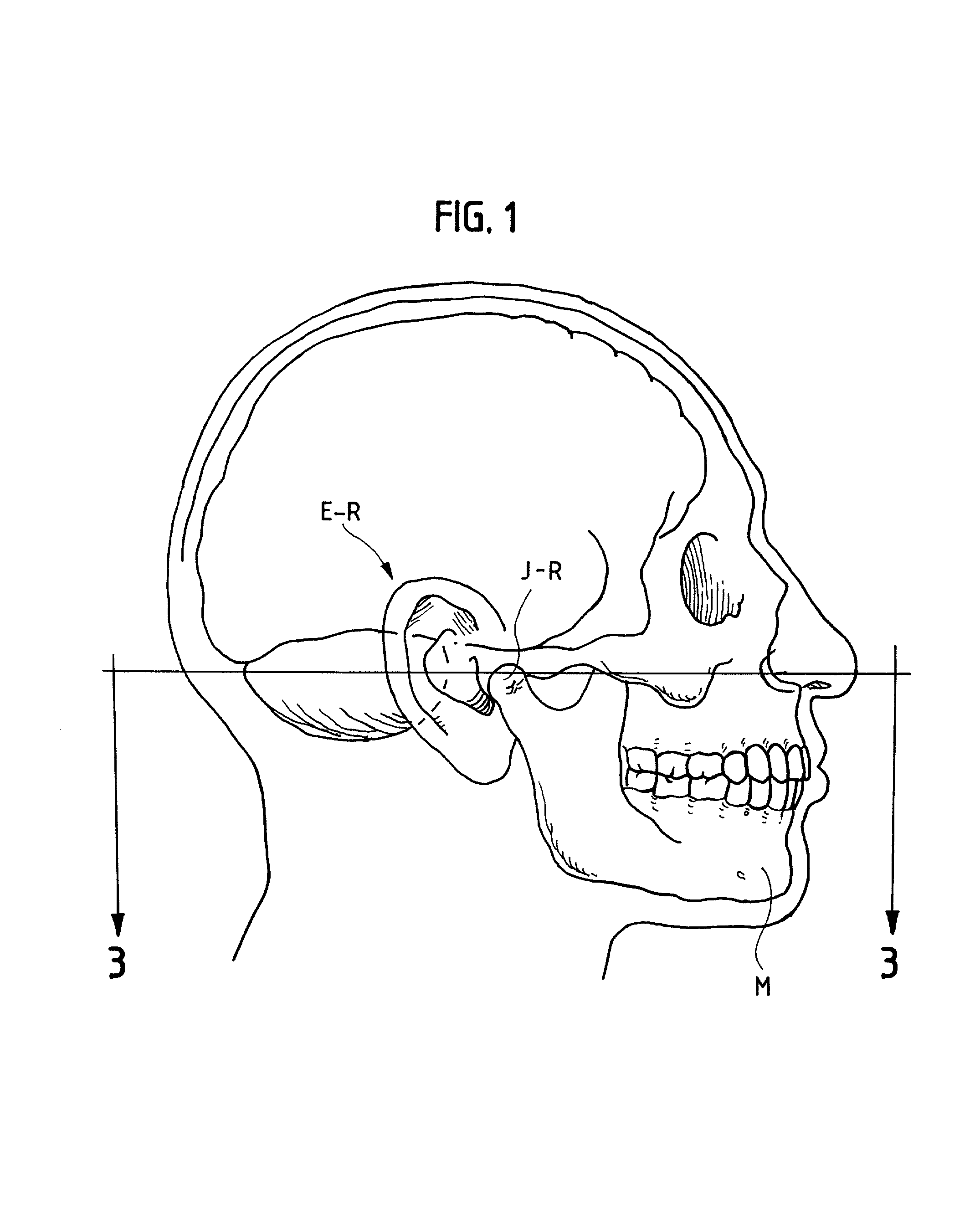 Compressible hearing aid