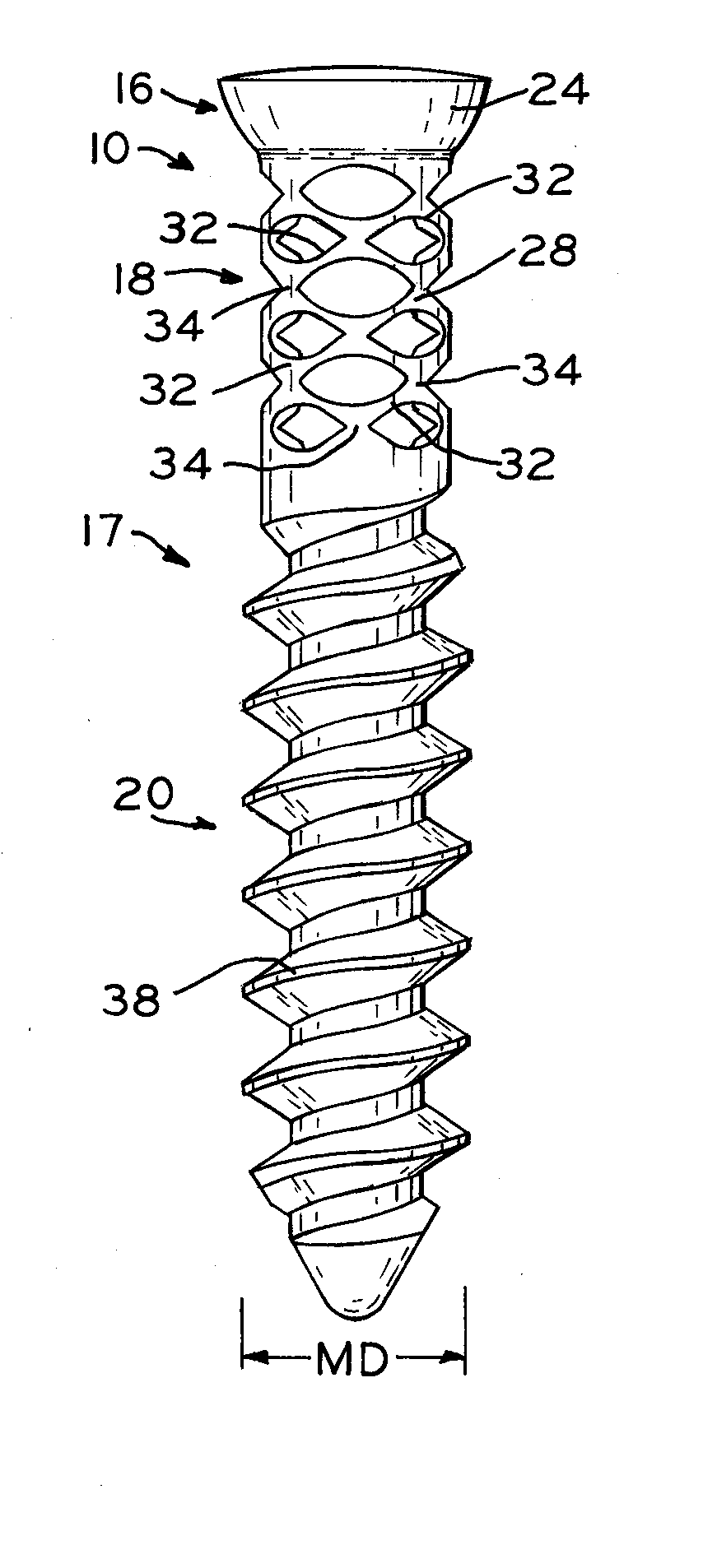 Bone screw for providing dynamic tension