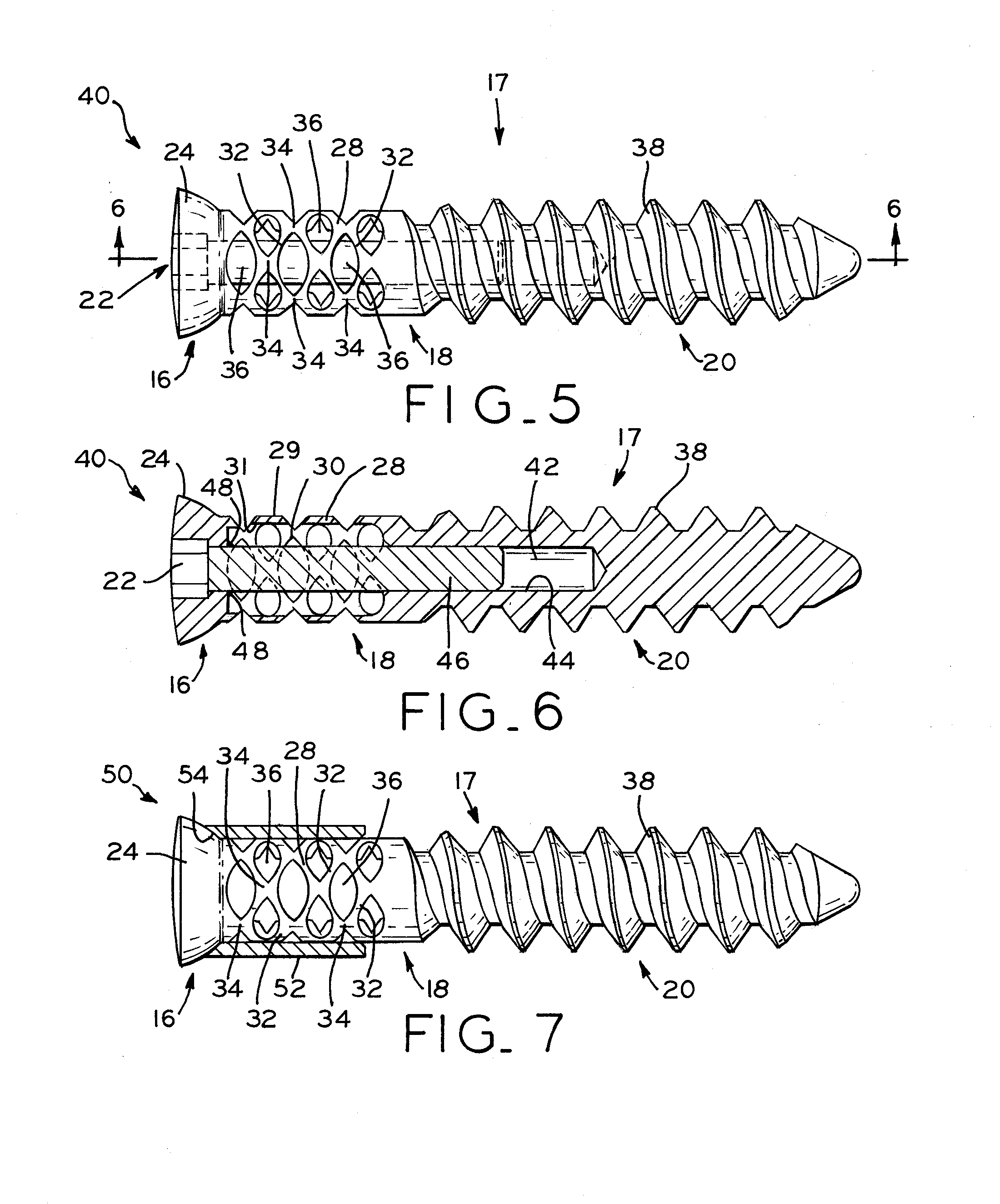 Bone screw for providing dynamic tension