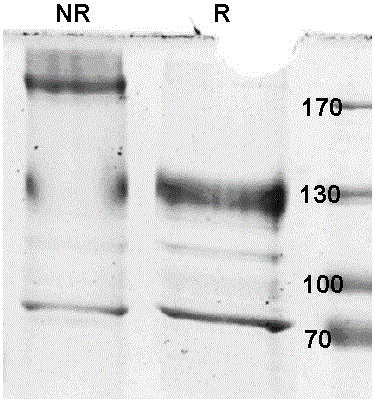 Interleukin-15 fusion protein for tumor targeting treatment