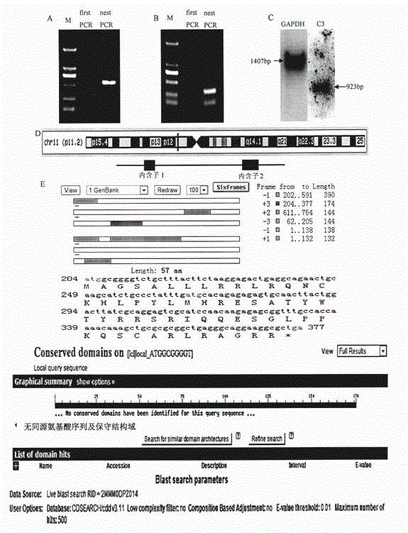 Human cervical carcinoma metastasis relevant new long chain non-coding RNA sequence, separation method and uses thereof