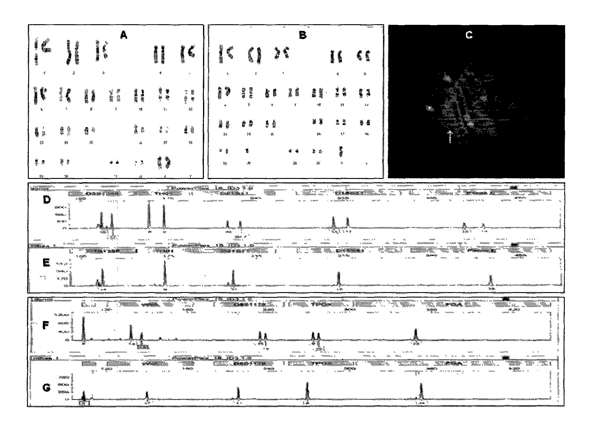 Human parthenogenetic embryo stem cell line with two active X chromosomes and derivatives thereof