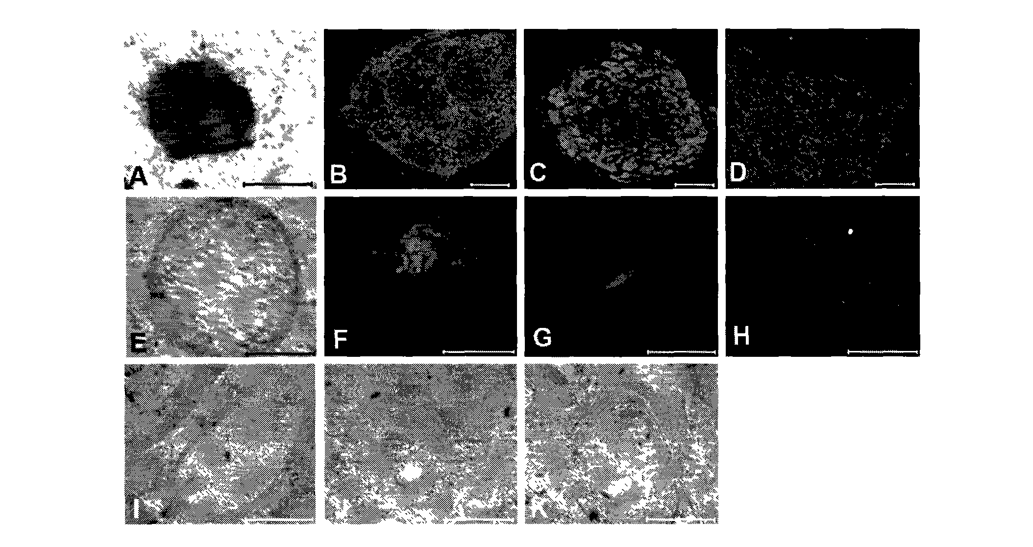 Human parthenogenetic embryo stem cell line with two active X chromosomes and derivatives thereof