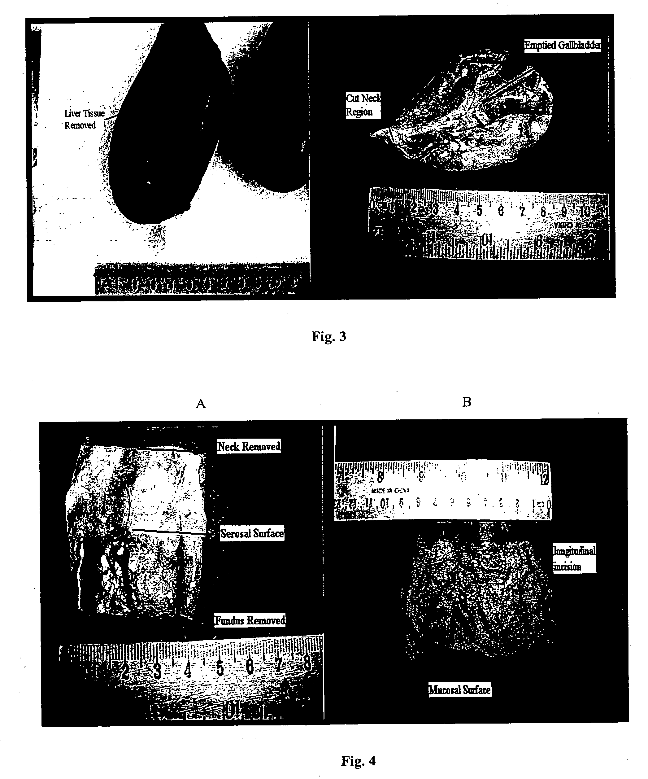 Tissue graft scaffold