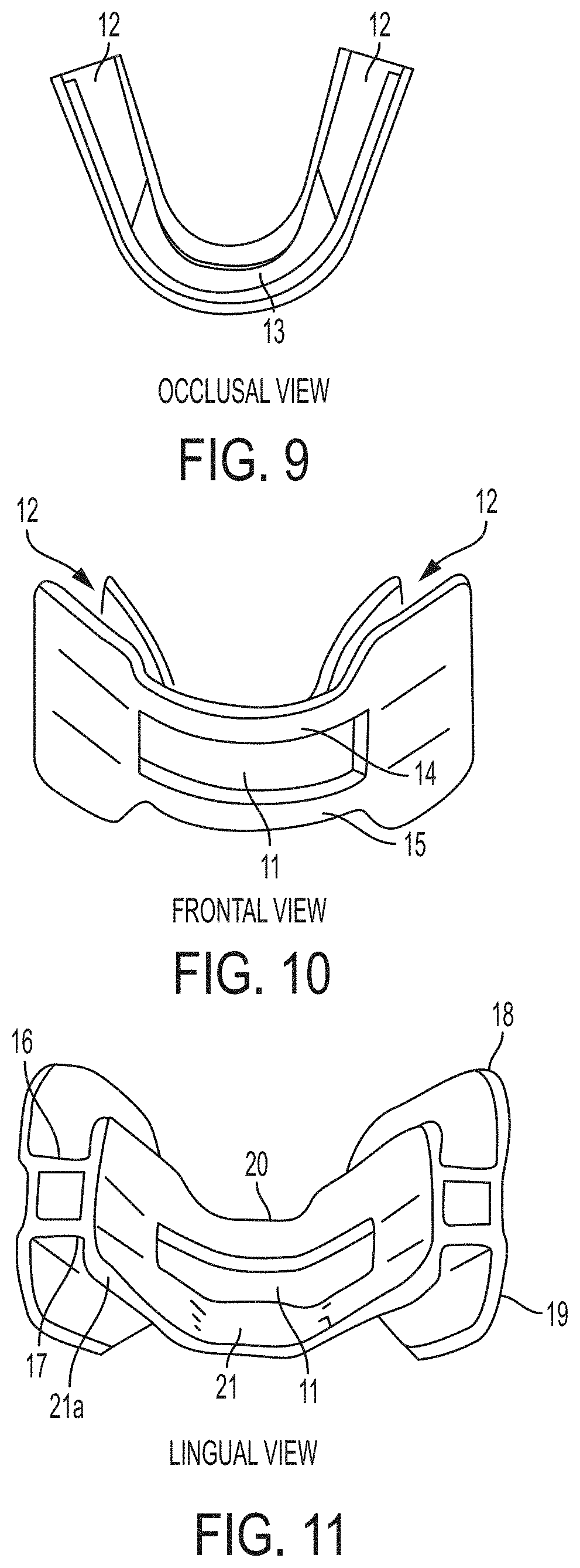 Low profile articulation jaw joint stabilizer device