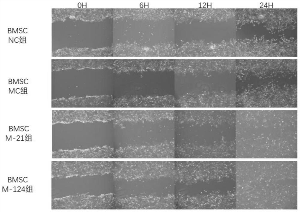 Recombinant mesenchymal stem cells and preparation method thereof