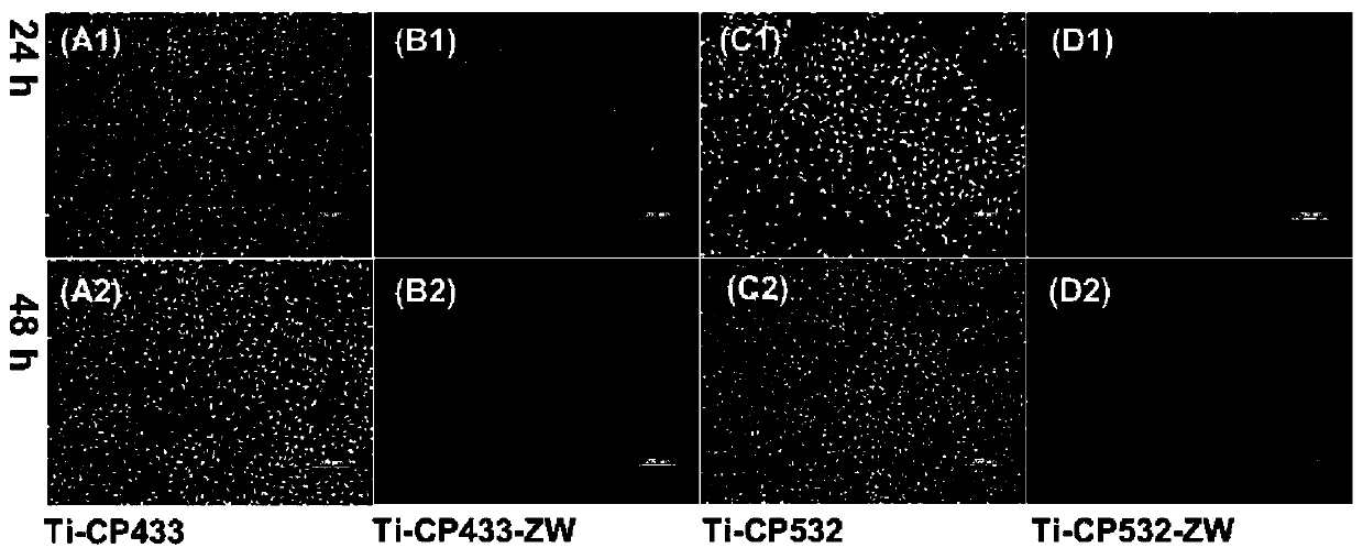 Carboxylic acid betaine zwitterionic composite antibacterial functional coating material and preparation method and application thereof