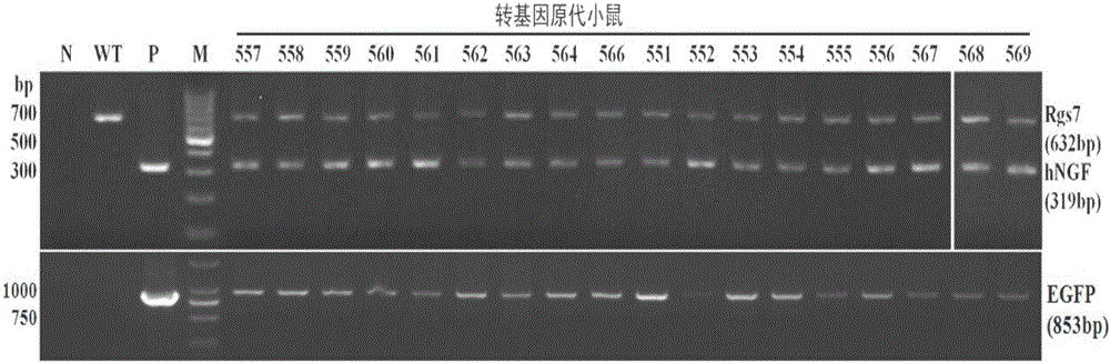 Mouse with human nerve growth factor transgenes as well as preparation method and application of mouse