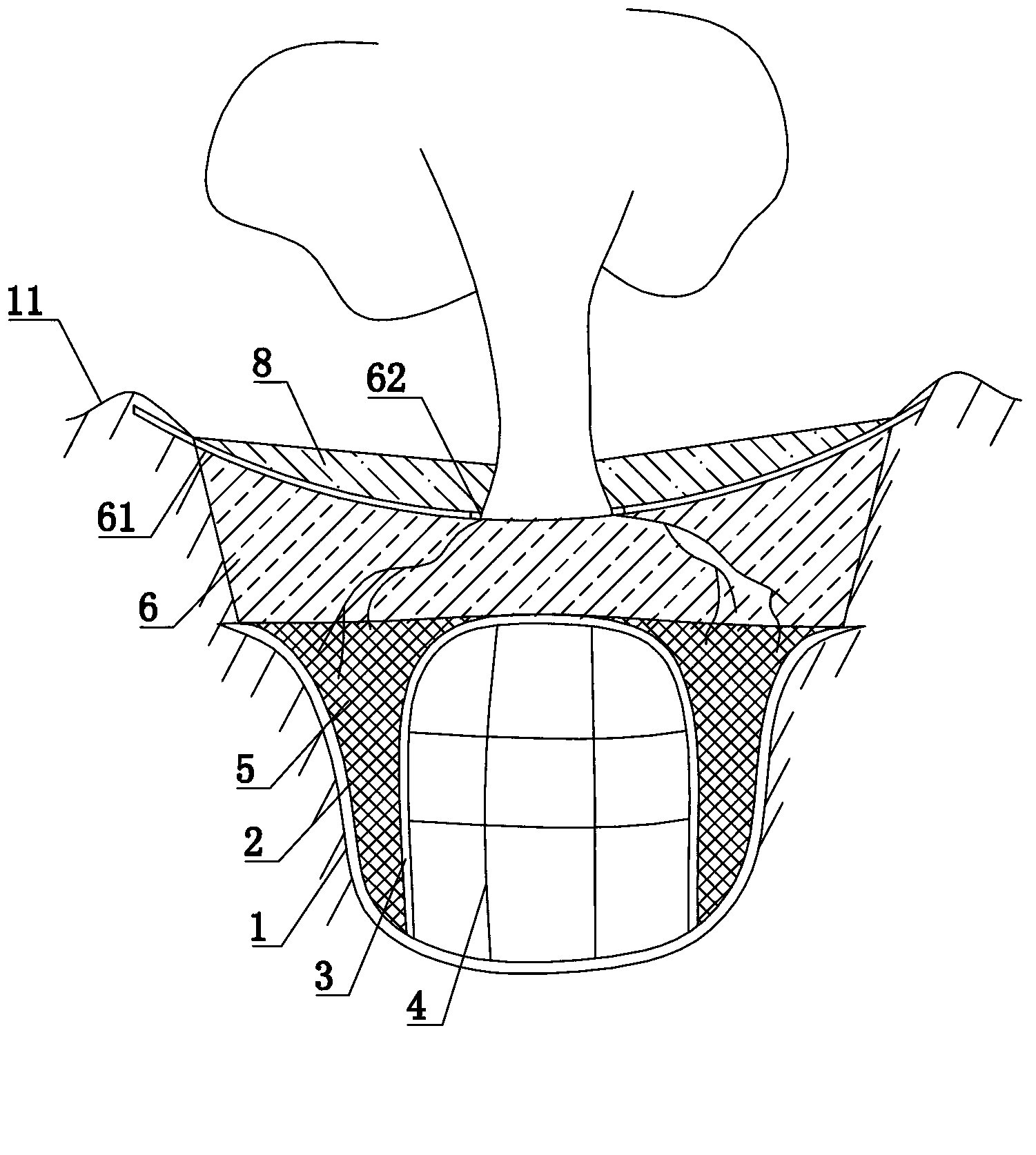 Water-storing bottom irrigation system for plants